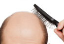 Erkeklerde saç dökülmesini azaltmanın 20 yolu